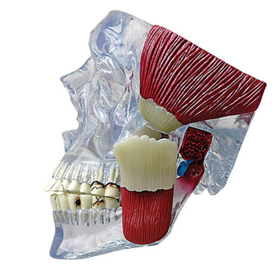 TMJ Disorder Model