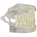 Switch The dental model is designed to show both normal dentition and occlusion on one side and many pathologies on the other 3 image