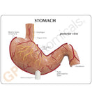 Switch Full-sized anatomical model of the stomach with pathologies 2 image