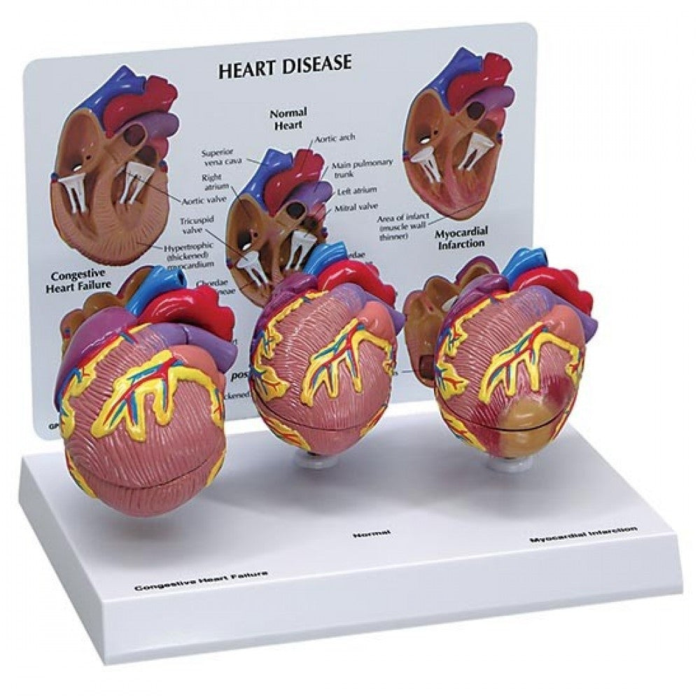 Heart Anatomy & Pathology Collection