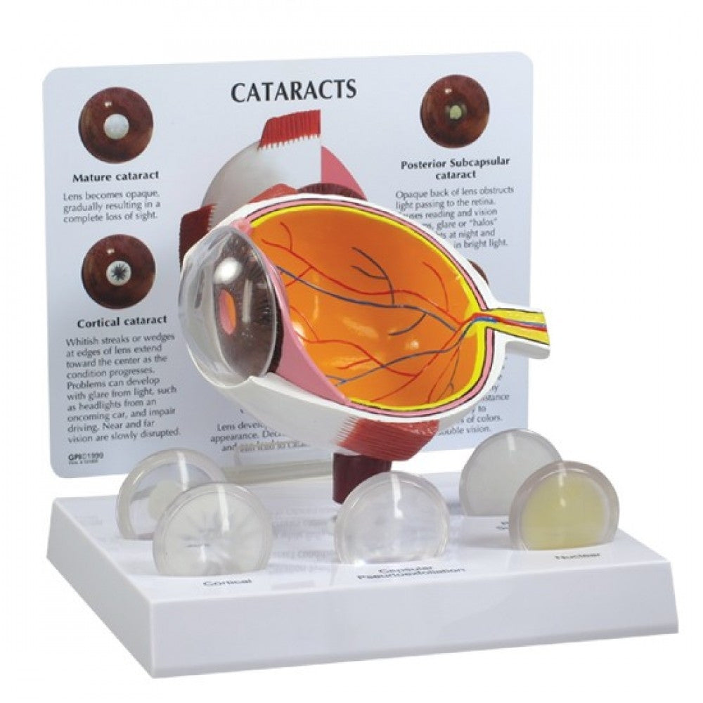 Eye Anatomy & Pathology Collection