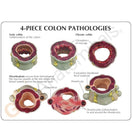 Switch A patient education card accompanies the model to help with identification of key parts 2 image