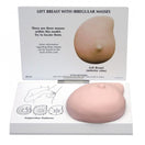 Switch Left Breast with Irregular Masses Model 4 image