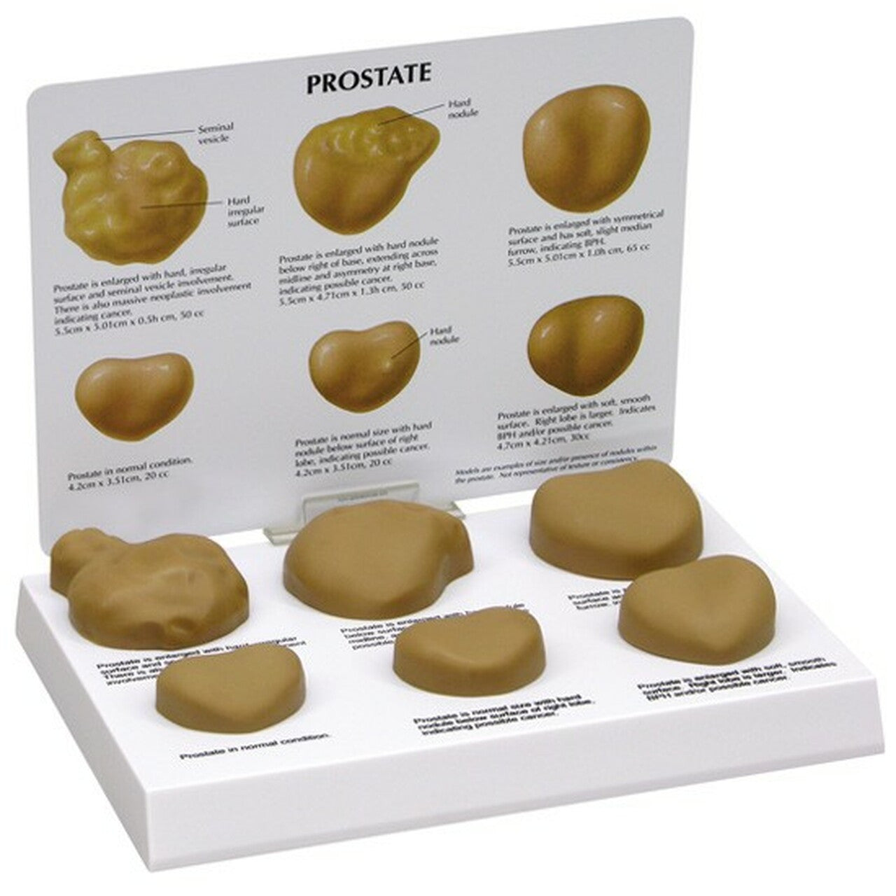 Prostate Anatomy & Pathology Collection