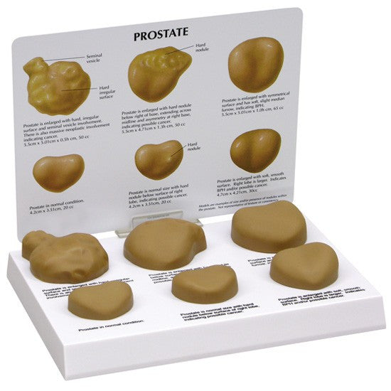 Prostate Conditions Model 3000
