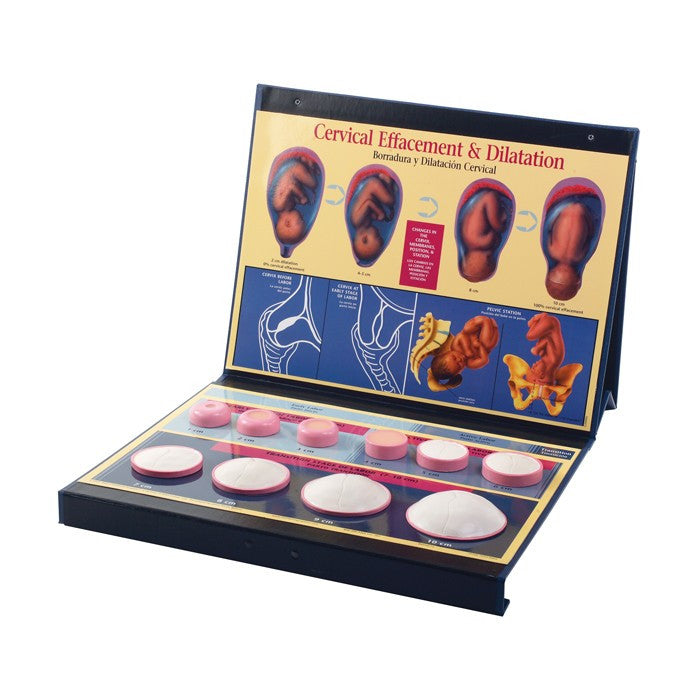 Cervical Effacement & Dilation Model