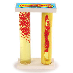 Deluxe Occluded Artery Model
