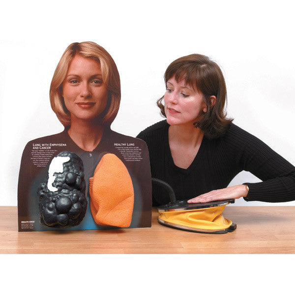 Lou-Wheeze Smoker's Lungs Comparison Model
