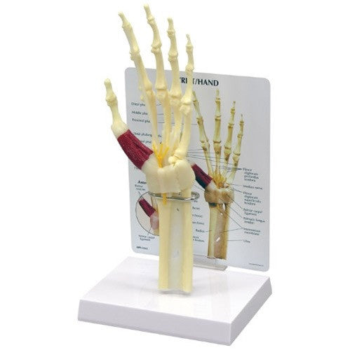 Life-size Hand and Wrist Model with Carpal Tunnel Syndrome