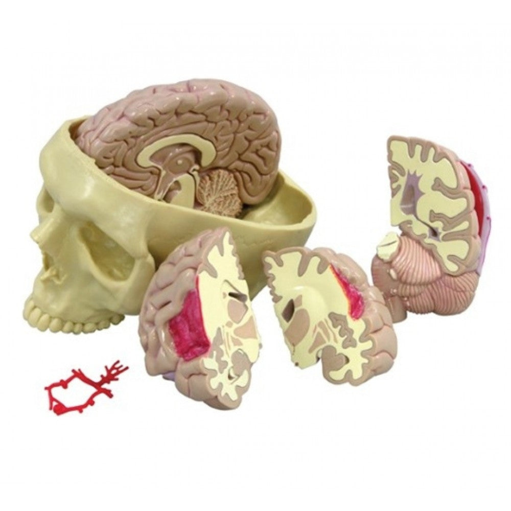 Brain Anatomy & Pathology Collection