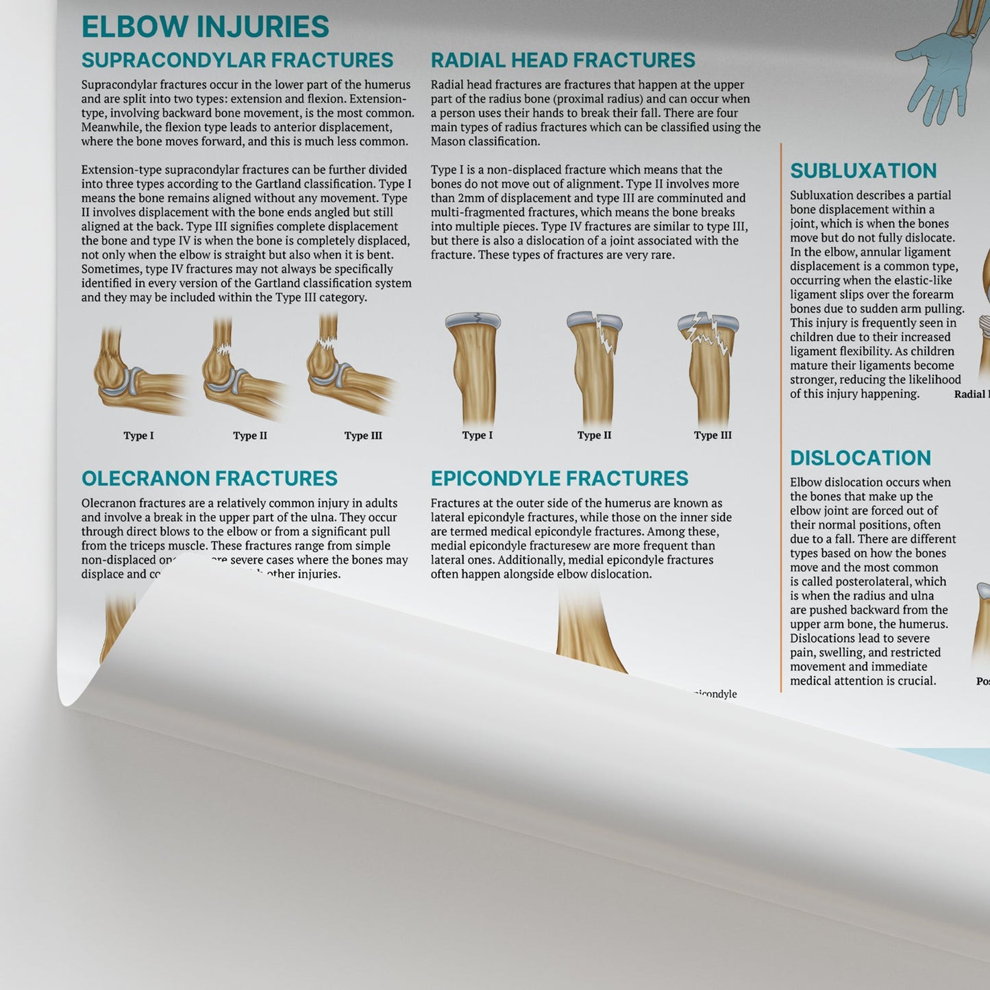Injuries & Conditions of the Elbow Chart / Poster - Part of Collection