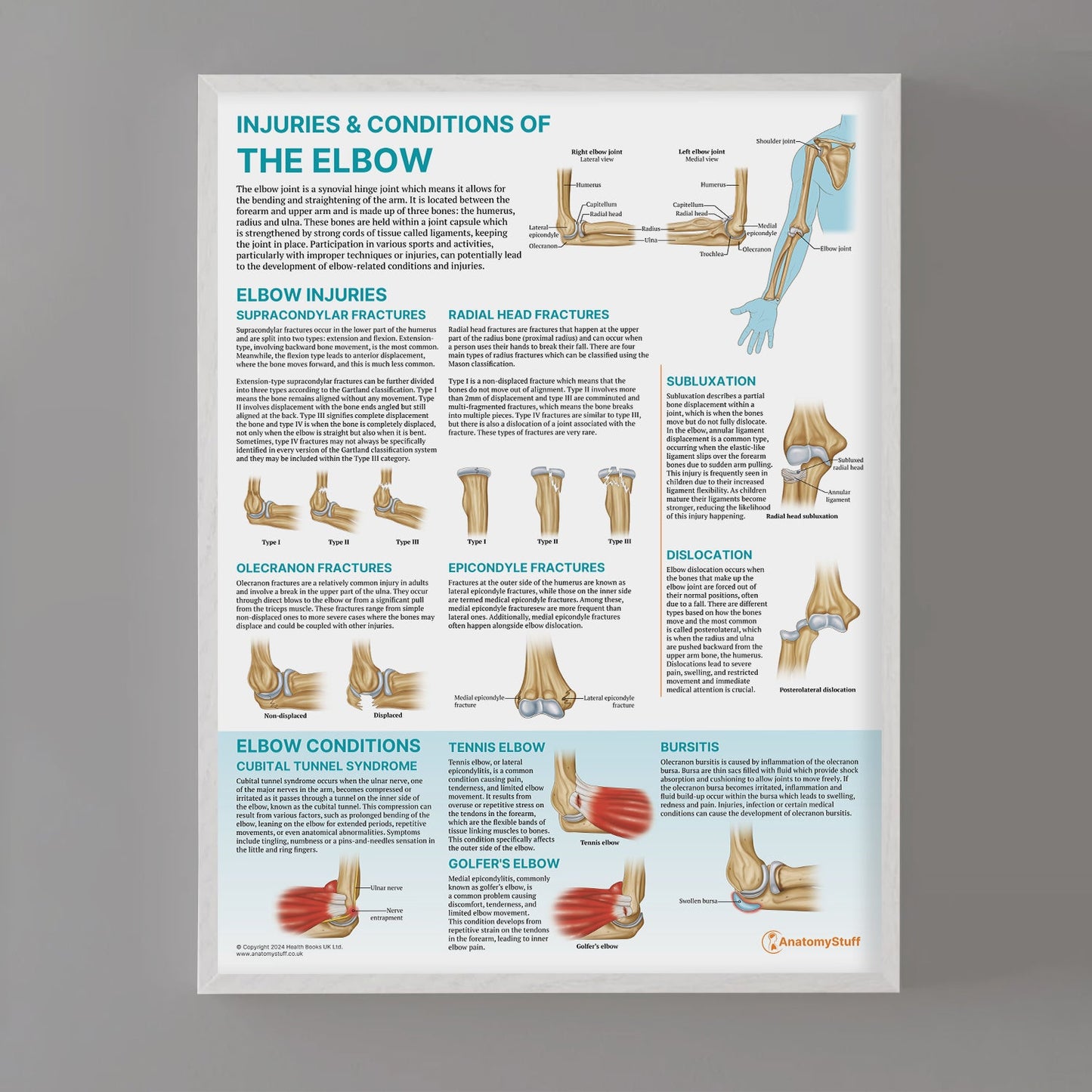 Injuries & Conditions of the Elbow Chart / Poster - Part of Collection
