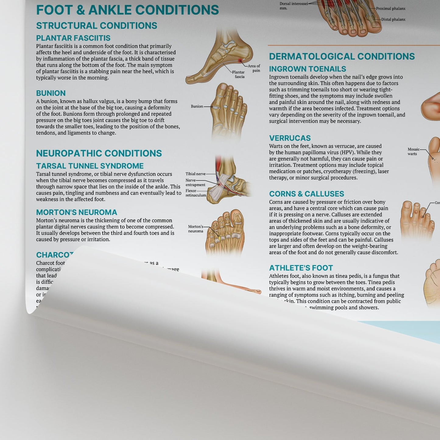 Injuries & Conditions of the Foot & Ankle Chart / Poster - Part of Collection