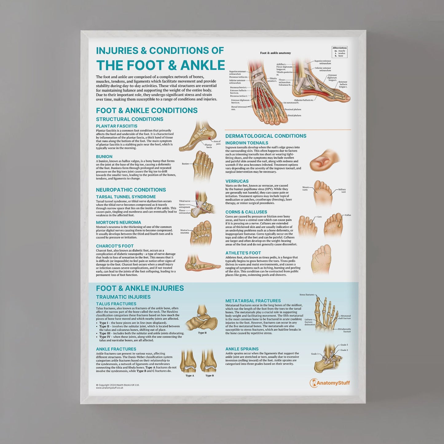 Injuries & Conditions of the Foot & Ankle Chart / Poster - Part of Collection