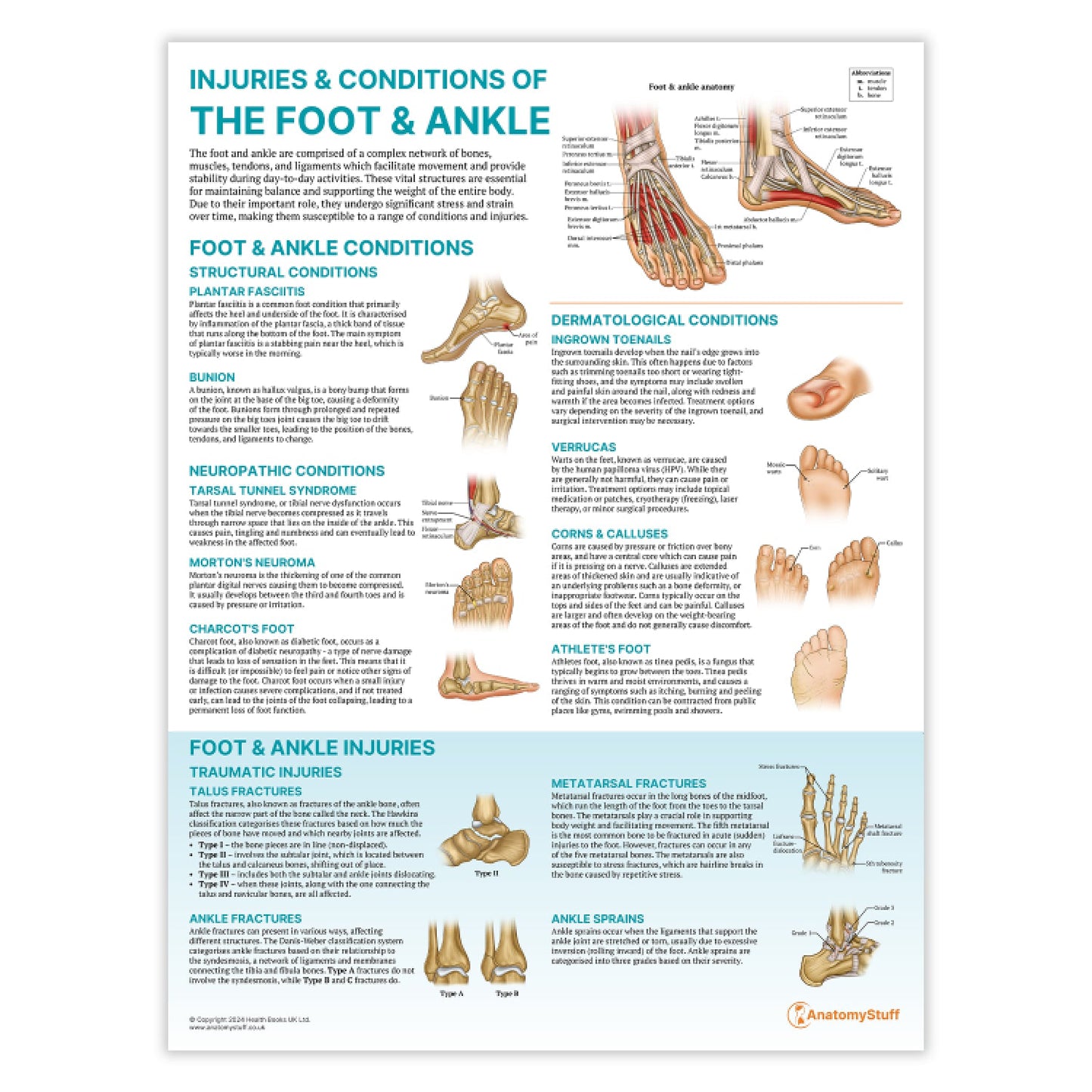 Injuries & Conditions of the Foot & Ankle Chart / Poster - Part of Collection