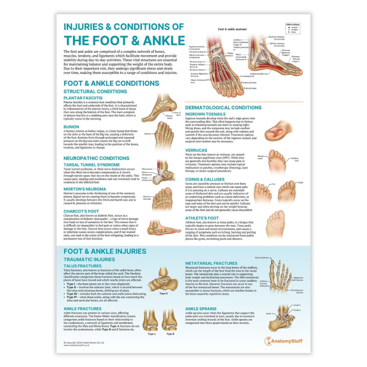 Injuries & Conditions of the Foot & Ankle Chart / Poster - Part of Collection