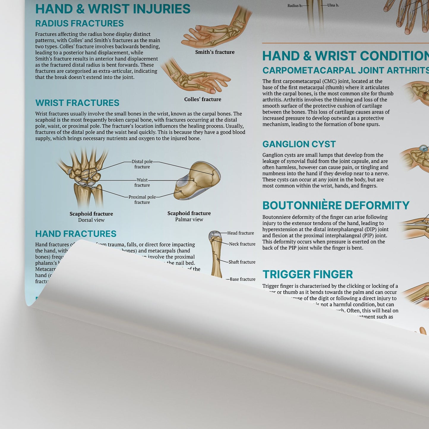 Injuries & Conditions of the Hand & Wrist Chart / Poster - Part of Collection