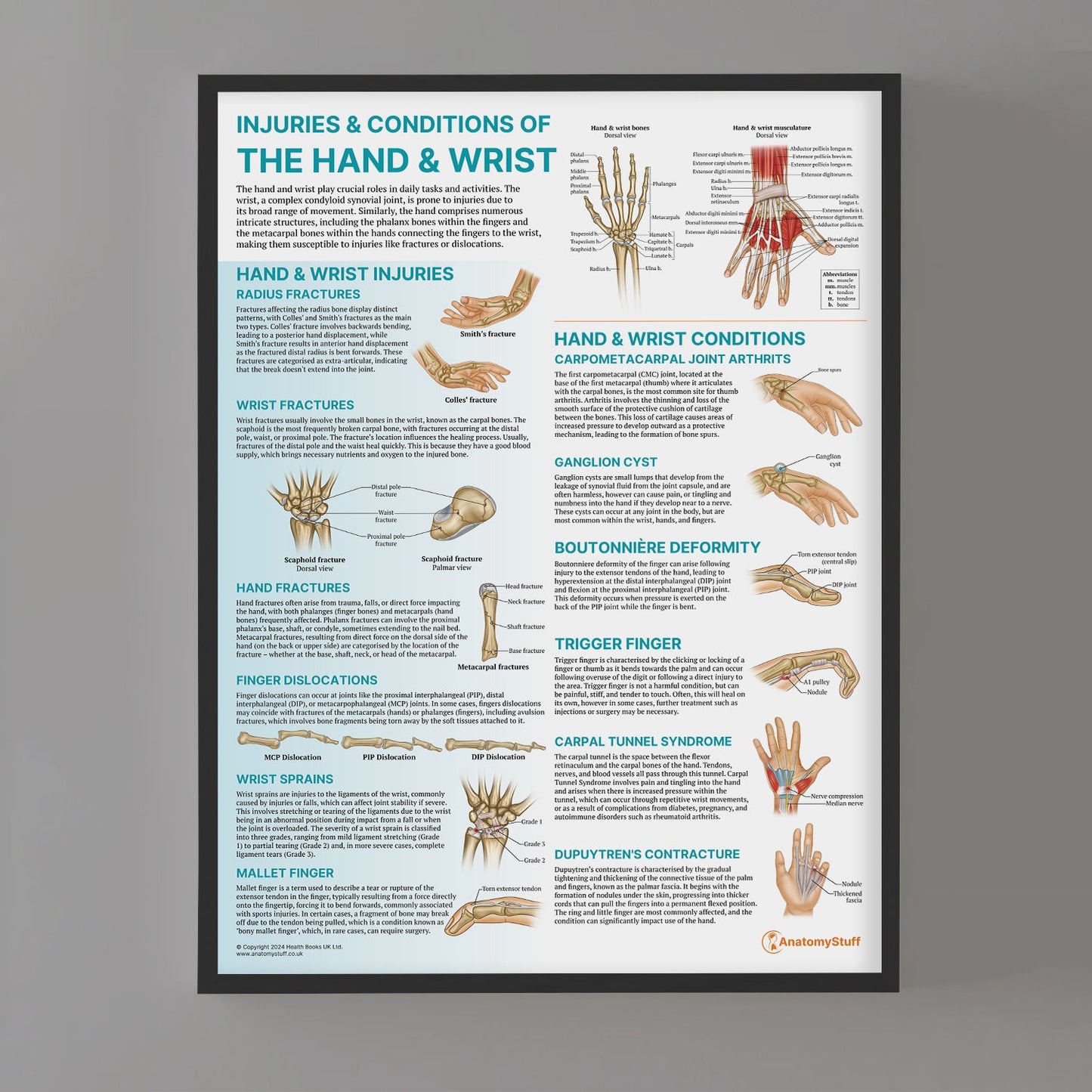 Injuries & Conditions of the Hand & Wrist Chart / Poster - Part of Collection