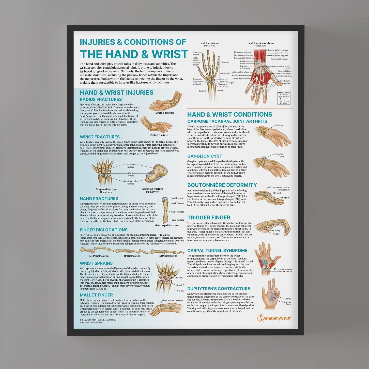 Injuries & Conditions of the Hand & Wrist Chart / Poster - Part of Collection