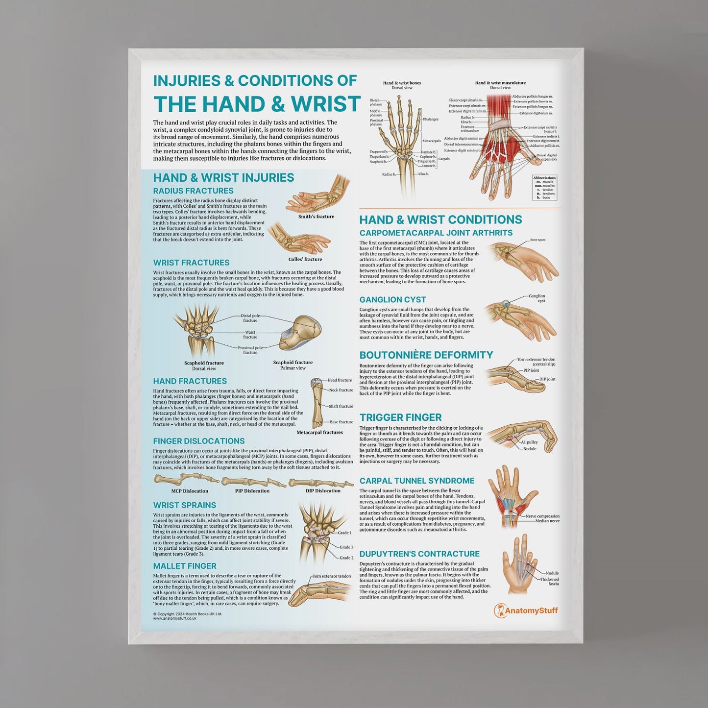 Injuries & Conditions of the Hand & Wrist Chart / Poster - Part of Collection