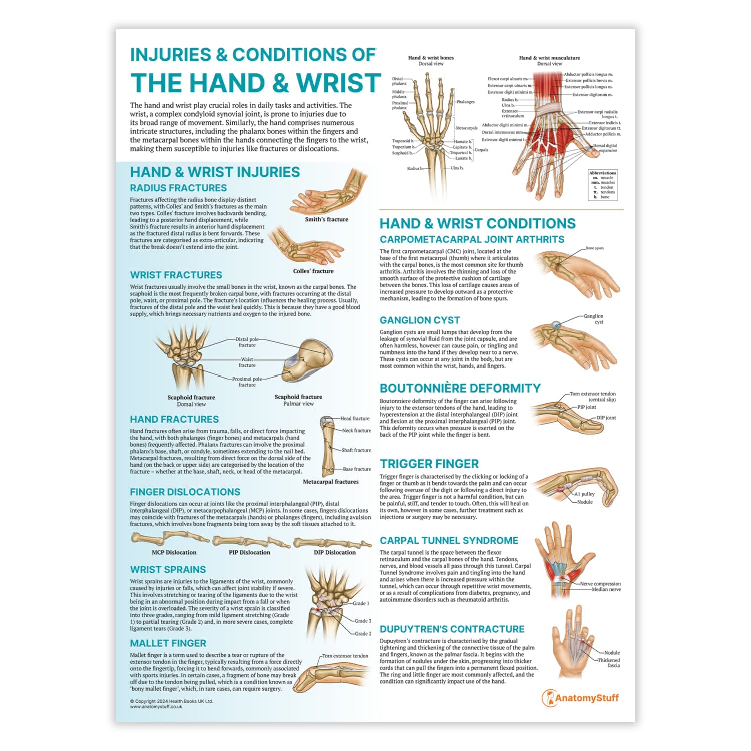 Injuries & Conditions of the Hand & Wrist Chart / Poster - Part of Collection