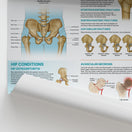 Switch Injuries &amp; Conditions of the Hip Chart / Poster 2 image
