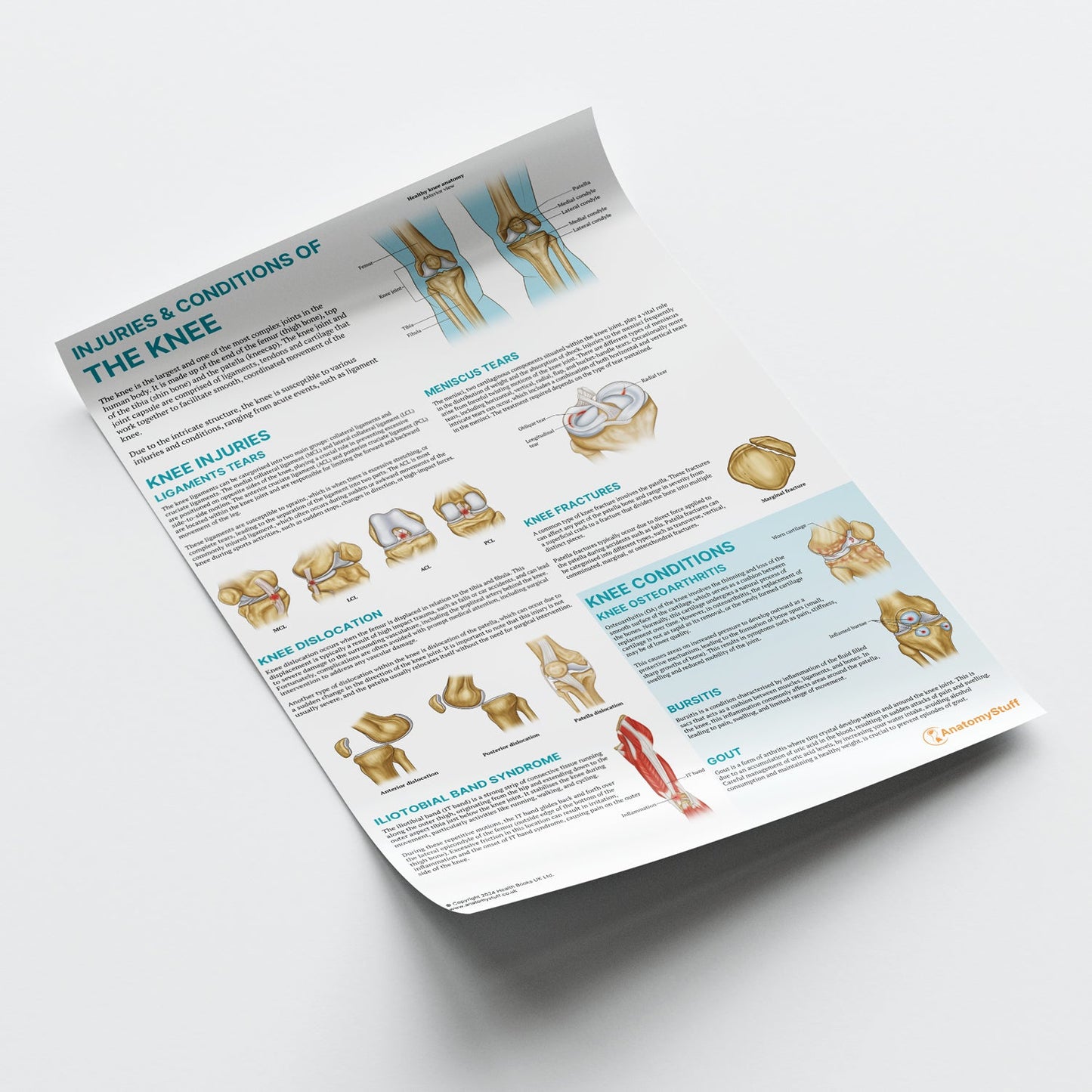 Injuries & Conditions of the Knee Chart / Poster - Part of Collection