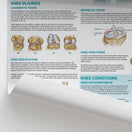 Switch Injuries &amp; Conditions of the Knee Chart / Poster 2 image