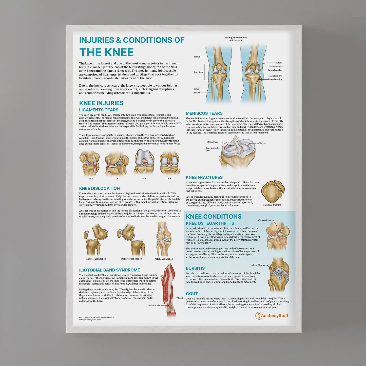 Injuries & Conditions of the Knee Chart / Poster - Part of Collection