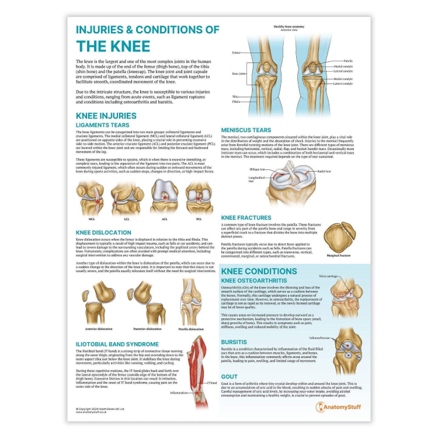 Injuries & Conditions of the Knee Chart / Poster - Part of Collection