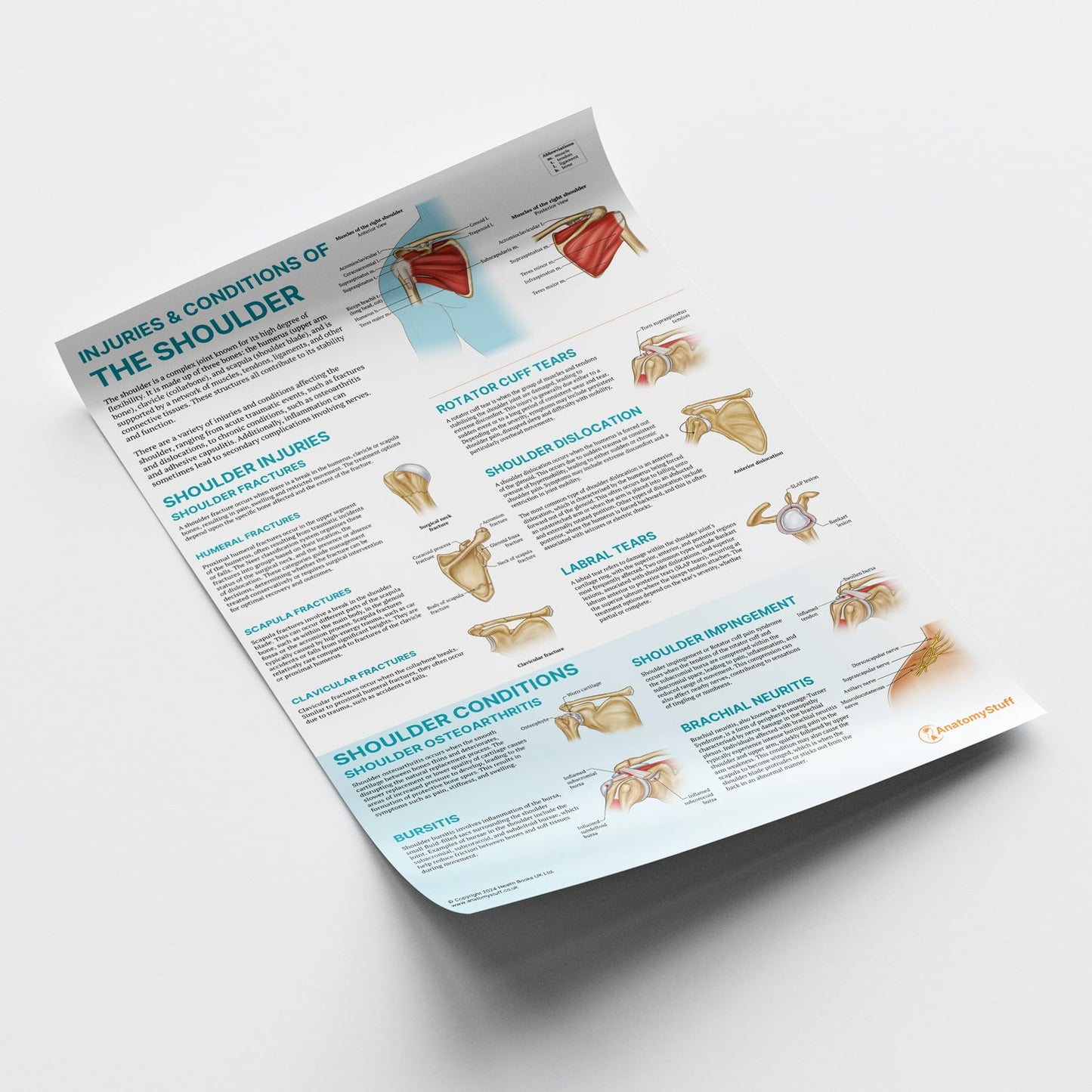 Injuries & Conditions of the Shoulder Chart / Poster - Part of Collection