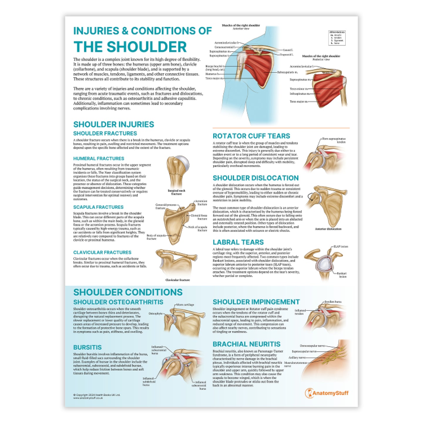 The Anatomy of The Shoulder Chart Injuries & Conditions Poster