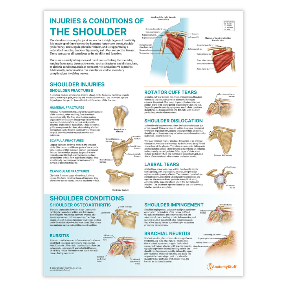 The Anatomy of The Shoulder Chart Injuries & Conditions Poster