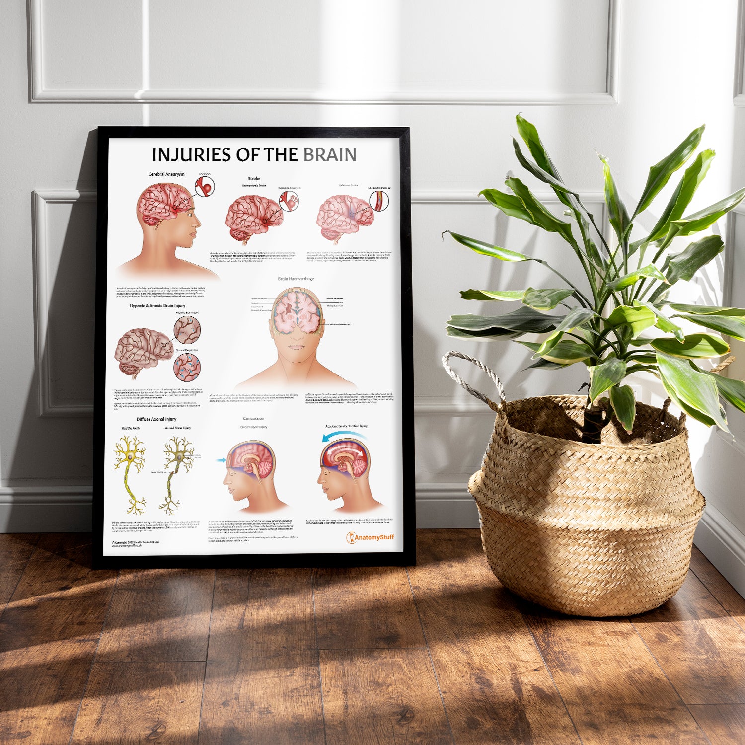 Injuries Of The Brain Chart / Poster