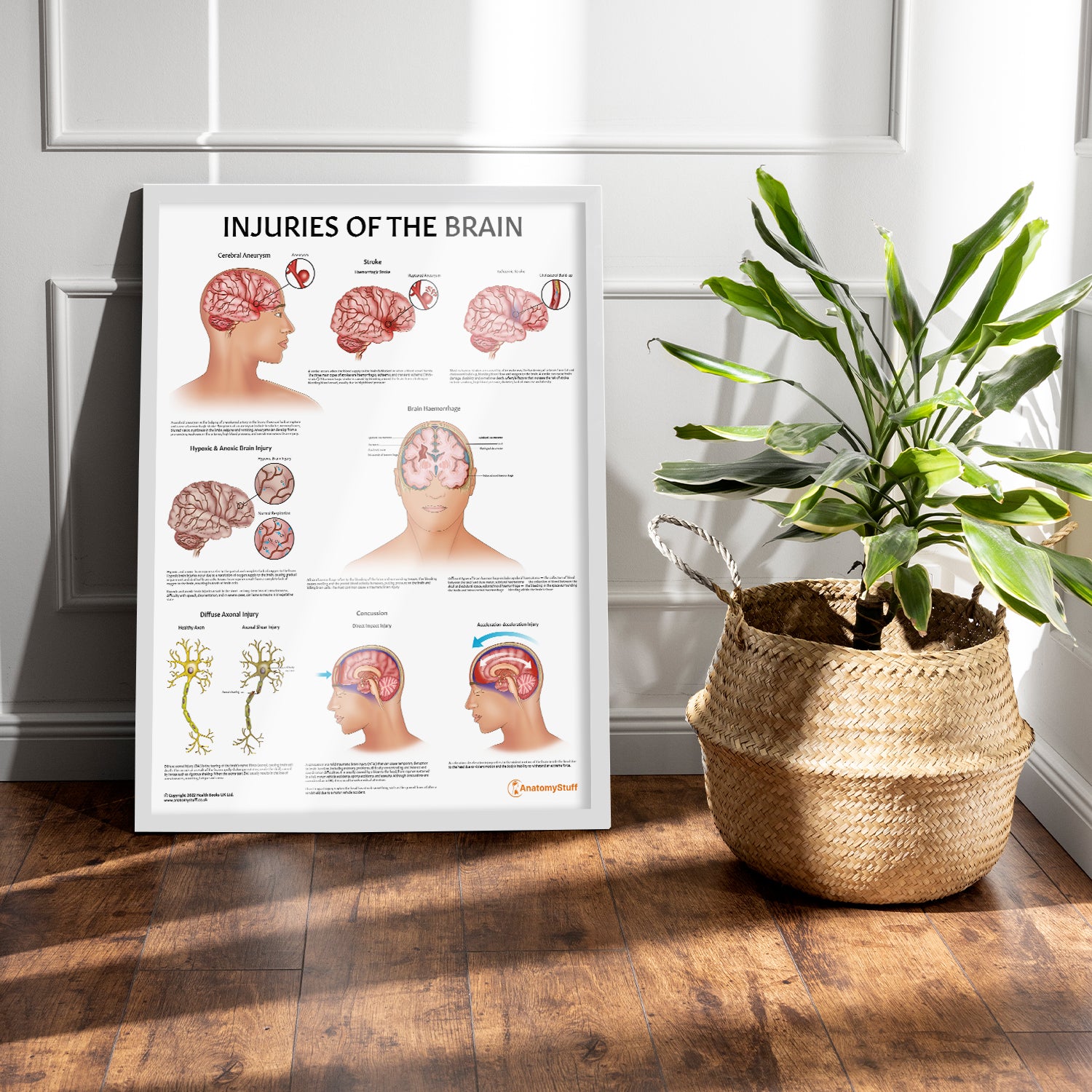 Injuries Of The Brain Chart / Poster