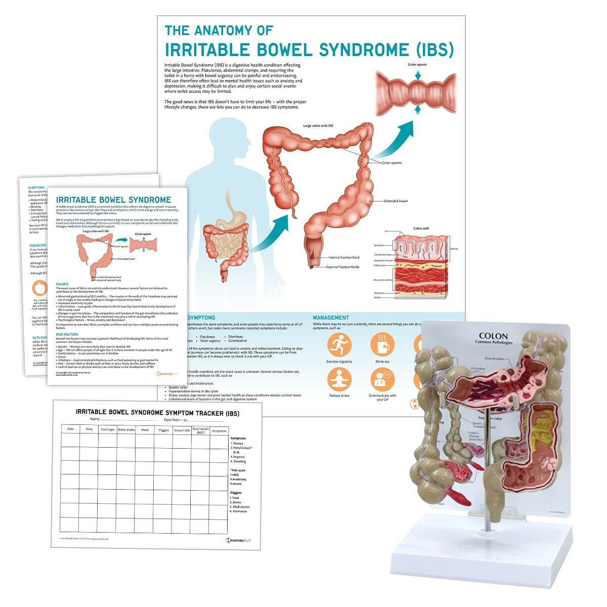 Irritable Bowel Syndrome Collection | IBS Charts & Models Set ...