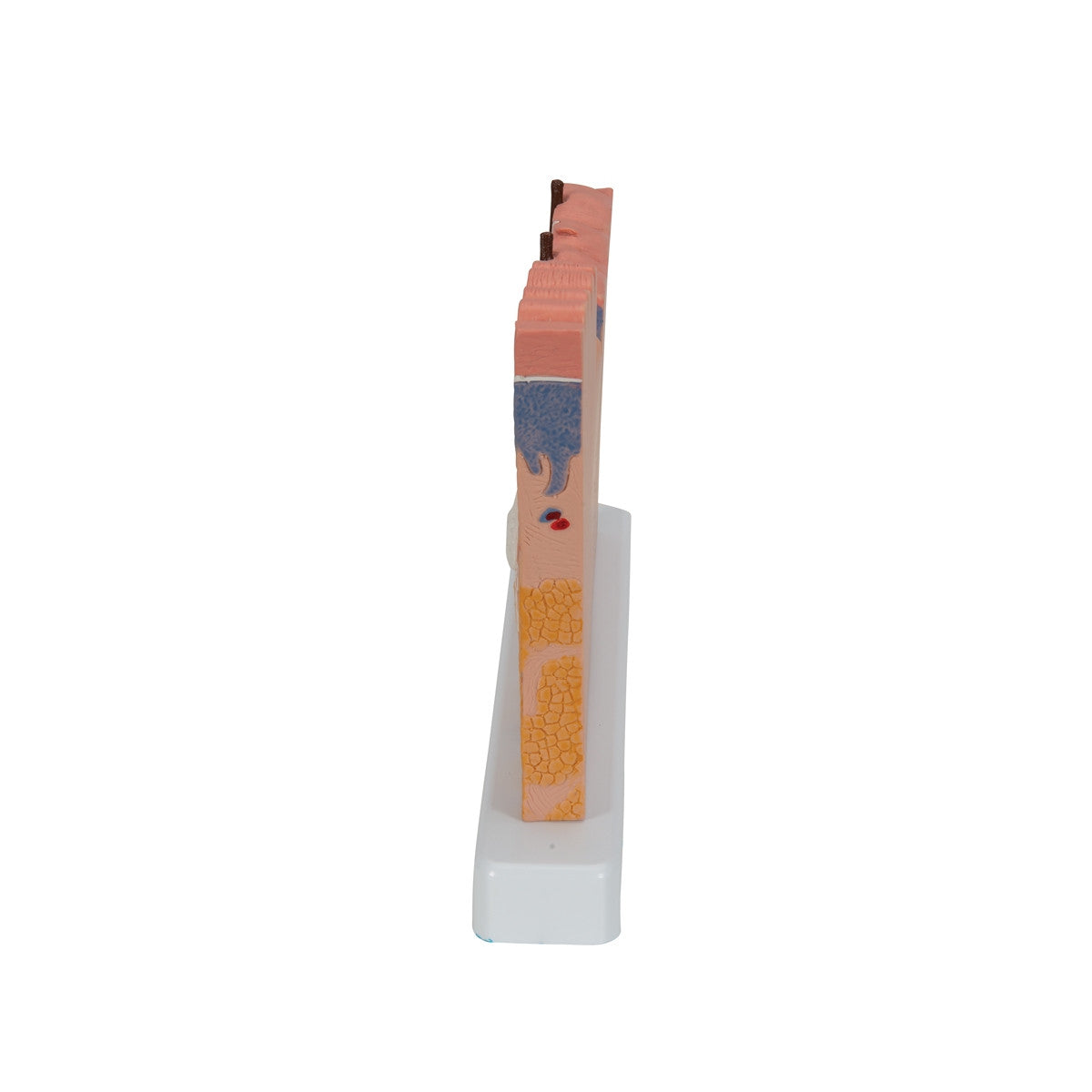 Skin Block Example Skin Section Model J11 / 1000290 | Skin Block Anatomy | 3B Scientific ...