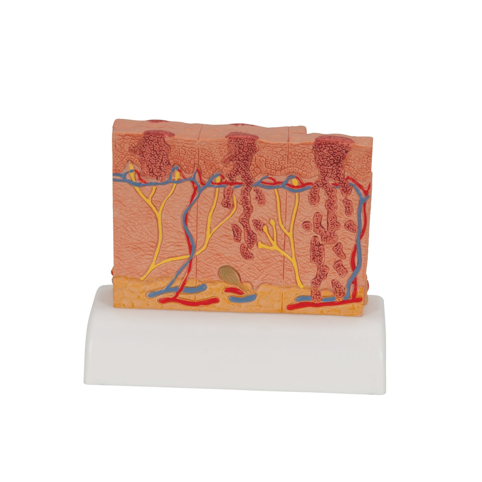 Skin Cancer Model (8 times life size)