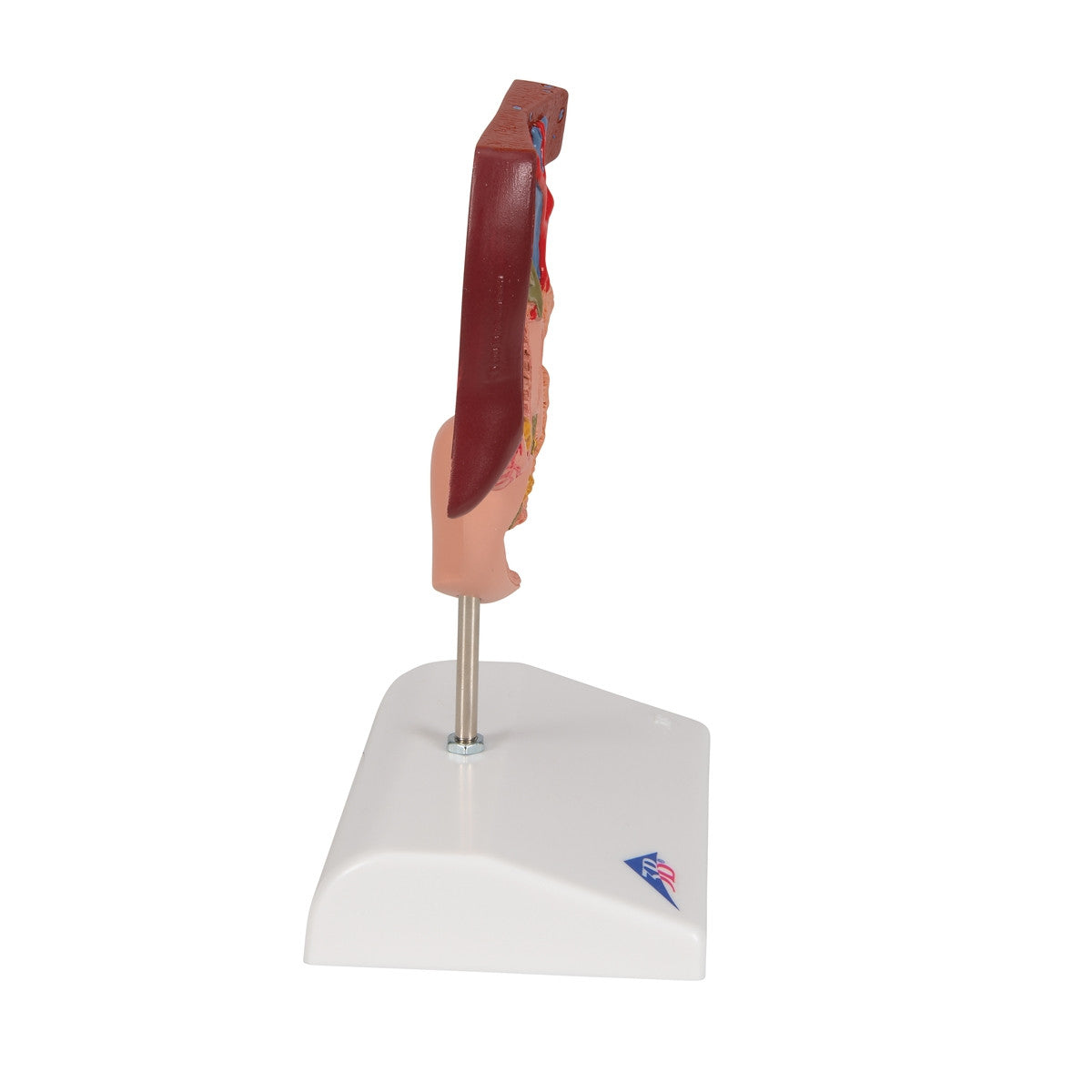 Gallstone Anatomical Model