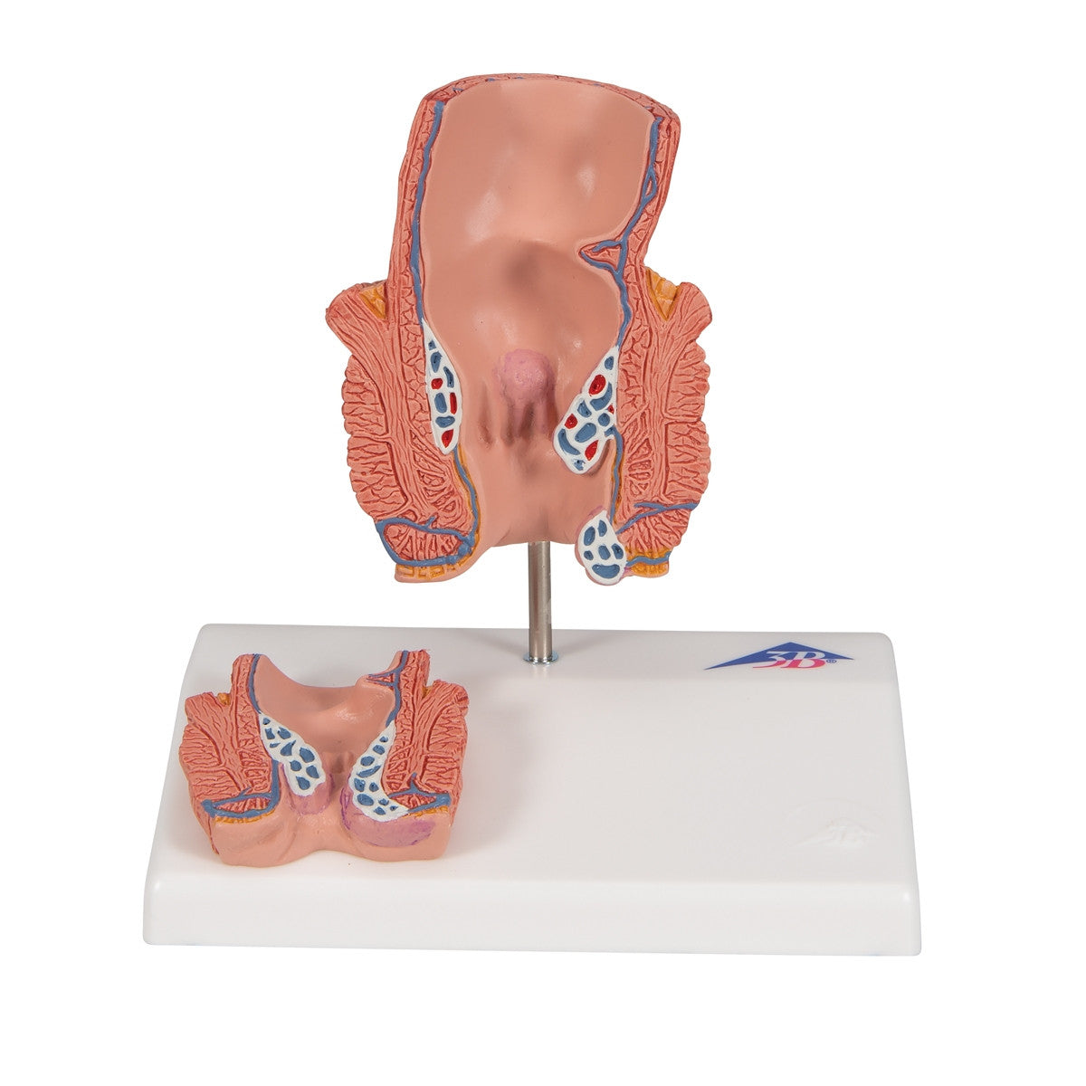 Haemorrhoid Anatomy Model