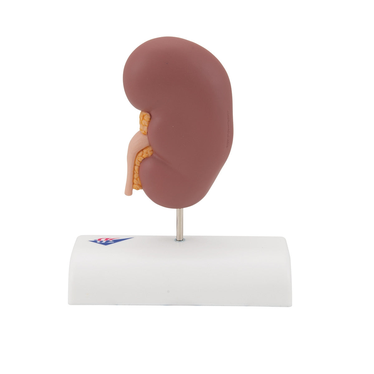Kidney Stone Anatomical Model