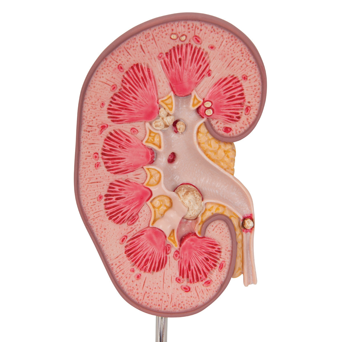 Kidney Stone Anatomical Model