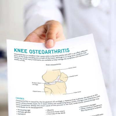 Knee Osteoarthritis Handout