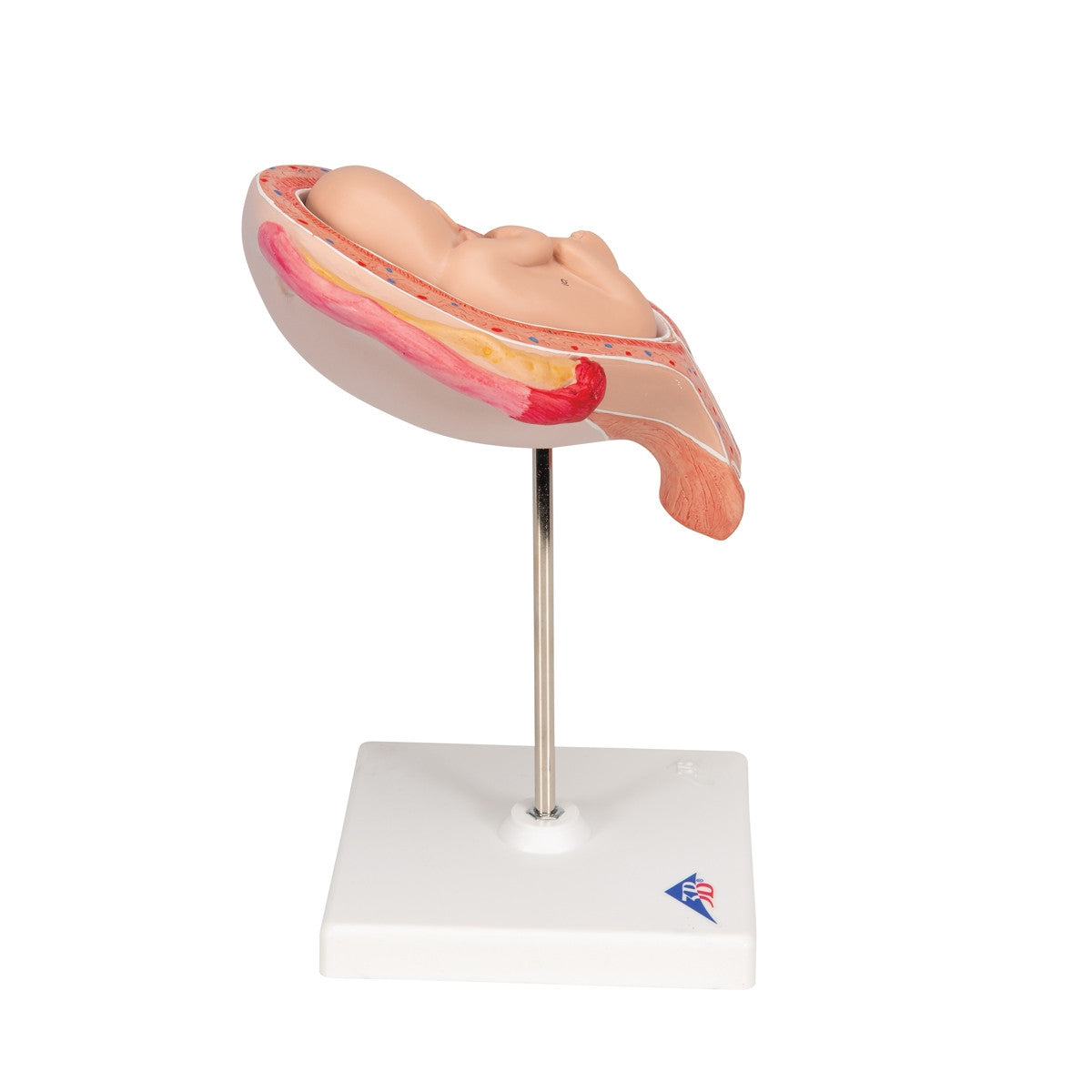 5th Month Foetus Model (Breech Position)