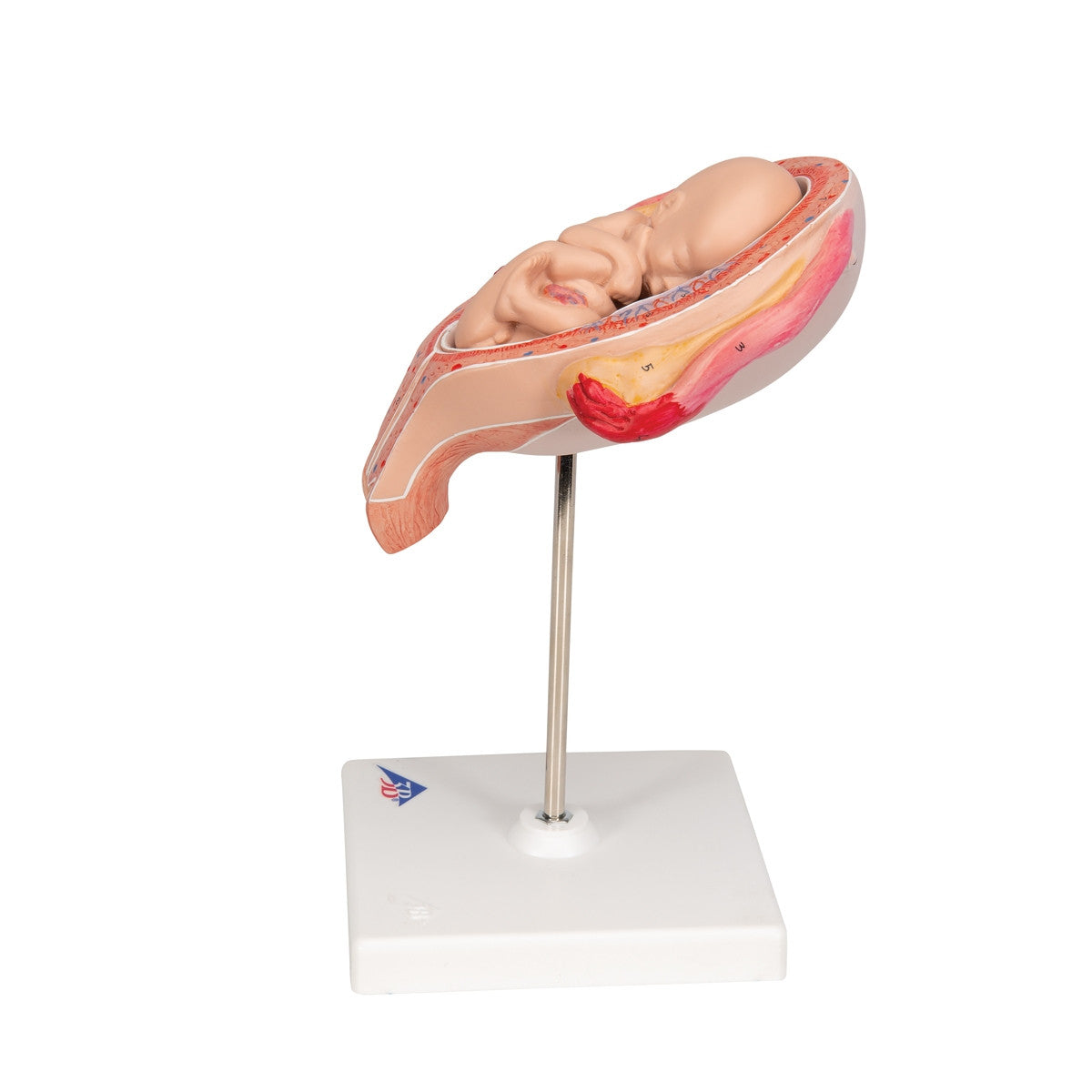 5th Month Foetus Model (Breech Position)