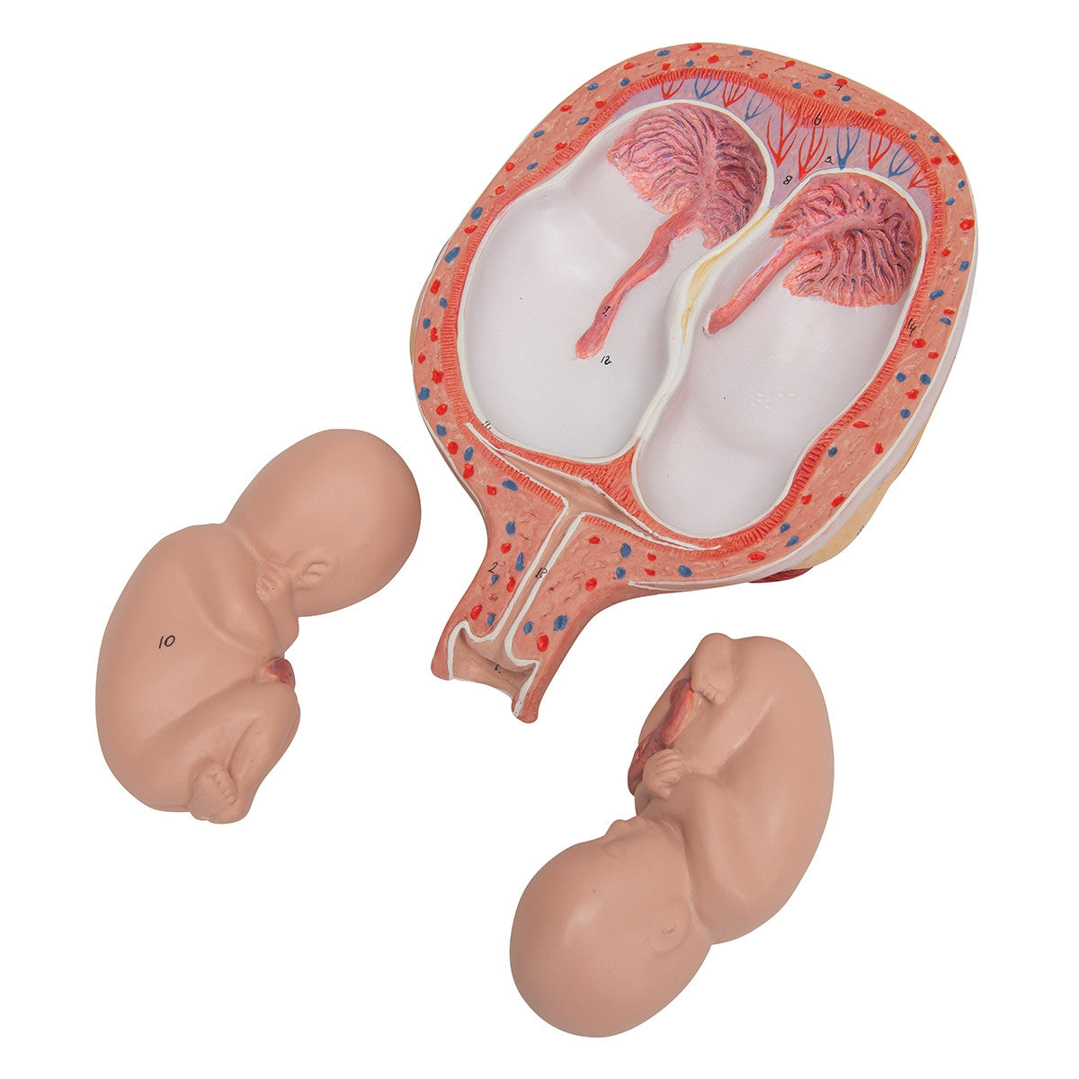 5th Month Twin Foetuses Model