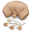 Switch Prostate Examination Simulator With Four Interchangeable Prostate Glands. Stage A Gland, Stage B Gland, Stage C Gland and Stage D Gland 2 image