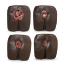 Switch Pressure Ulcer / Bedsore Model Set (Dark) 2 image