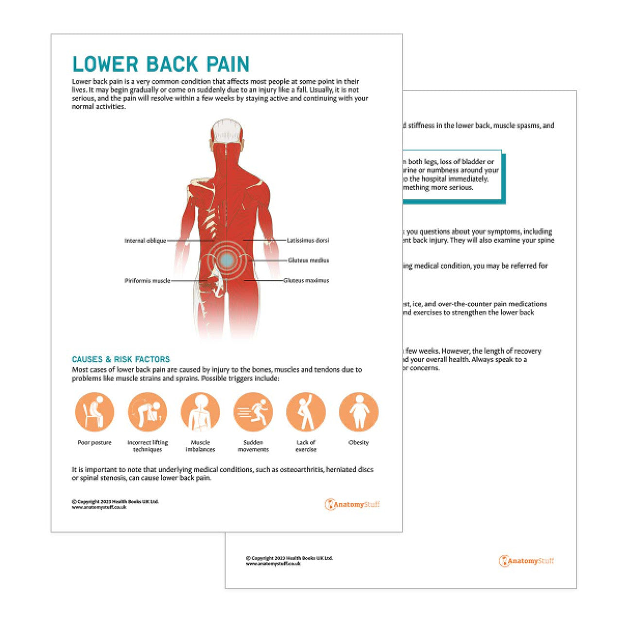 Lower Back Pain Collections | Low Back Pain Charts & Models Set ...