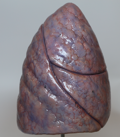 Lungs Model